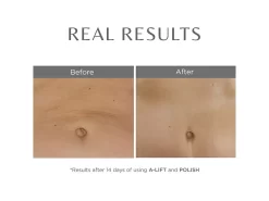 COSMEDIX A-Lift Overnight Vitamin A Body Treatment 7 COSMEDIX A-Lift Overnight Vitamin A Body Treatment -Classic Skin Care Product Store m0pigogq 202303311634431515