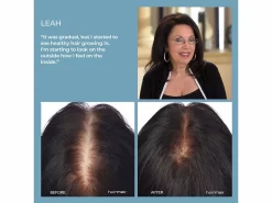 HairMax Ultima 9 Classic LaserComb Hair Growth Device -Classic Skin Care Product Store m1bfa5q3 202211092055222984