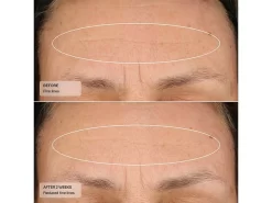 Senté Dermal Repair Cream -Classic Skin Care Product Store mnravosj 202305051332330308