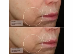 Senté Dermal Contour Pressed Serum -Classic Skin Care Product Store nal5rxyc 202305051459380241