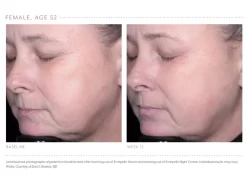 Emepelle Serum -Classic Skin Care Product Store njjr15zb 202102161752147095