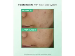 StriVectin Multi-Action Gentle Daily Clarifying Cleanser 9 StriVectin Multi-Action Gentle Daily Clarifying Cleanser -Classic Skin Care Product Store nxnt2iiw 202303221420237202