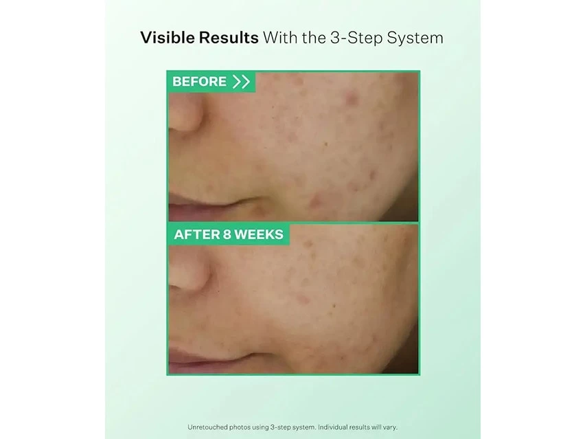 StriVectin Multi-Action Gentle Daily Clarifying Cleanser 3 StriVectin Multi-Action Gentle Daily Clarifying Cleanser - Image 3