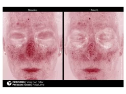 Jan Marini RosaLieve Redness Reducing Complex -Classic Skin Care Product Store o1wkjq2p 201803121532577435