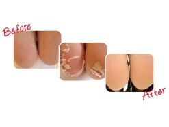 Baby Foot Exfoliation Foot Peel -Classic Skin Care Product Store onsxescf 201905061251518273