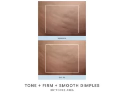 NuFACE NuBODY Skin Toning Device -Classic Skin Care Product Store opm5apof 202201101536136674