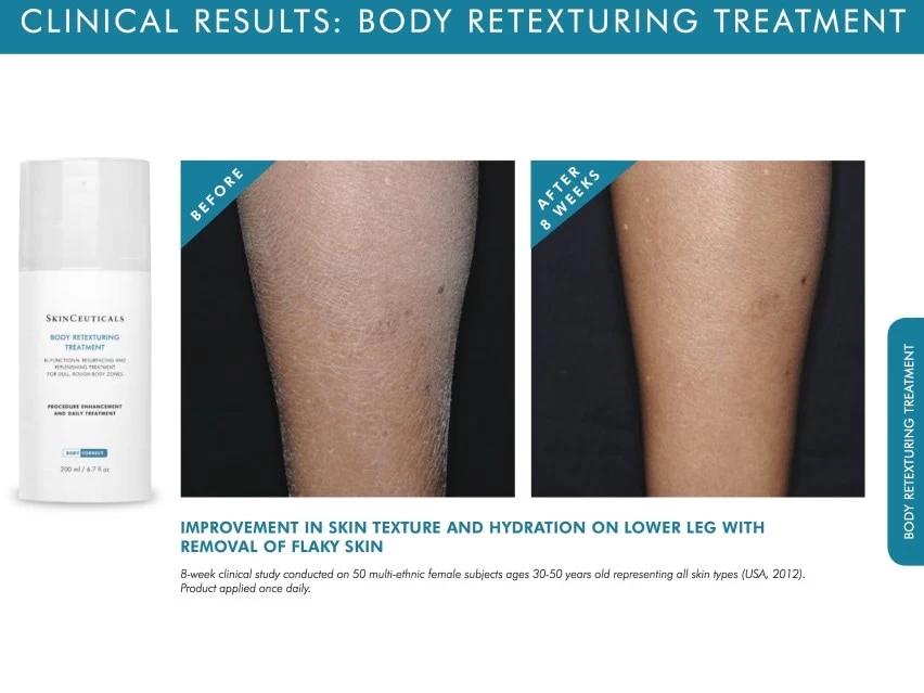 SkinCeuticals Body Retexturing + Exfoliating Treatment 2 SkinCeuticals Body Retexturing + Exfoliating Treatment - Image 2