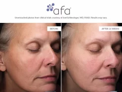 Afa Restorative Gel Plus -Classic Skin Care Product Store ouzz0hyg 202107131933207074