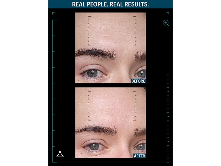 Allies Of Skin Multi Peptides & GF Advanced Lifting Serum 3 Allies Of Skin Multi Peptides & GF Advanced Lifting Serum - Image 3