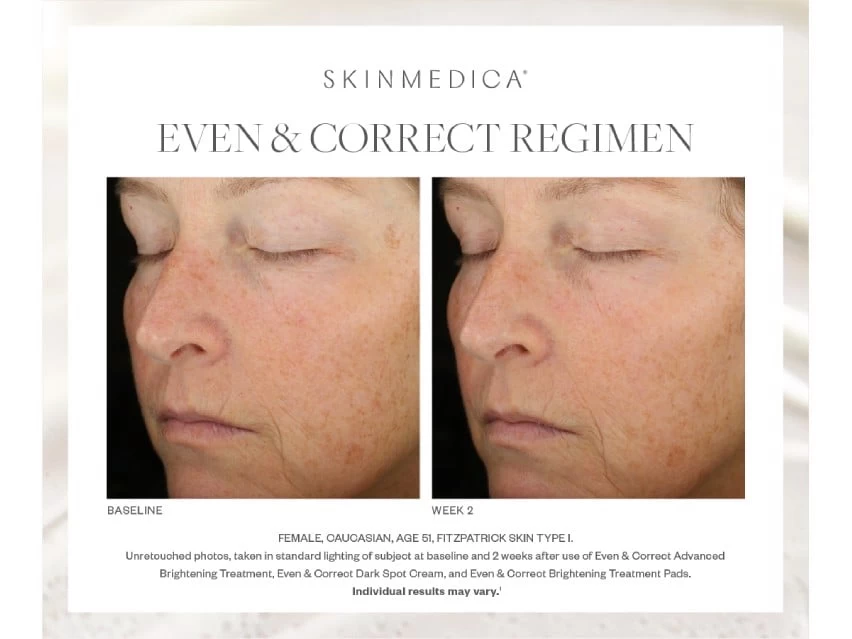 SkinMedica Even & Correct Brightening Treatment Pads 2 SkinMedica Even & Correct Brightening Treatment Pads - Image 2