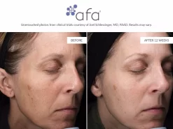 Afa Restorative Gel Max -Classic Skin Care Product Store psixf2xv 202107131901406156