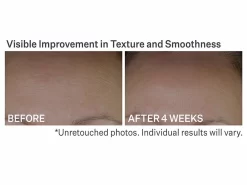 StriVectin Anti-Wrinkle Peptide Plump Line Filling Bounce Serum -Classic Skin Care Product Store qofxop05 202210271659103215