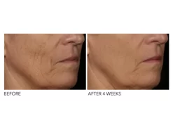 Dr. Dennis Gross Skincare DRx SpectraLite™ FaceWare Pro 7 Dr. Dennis Gross Skincare DRx SpectraLite™ FaceWare Pro -Classic Skin Care Product Store qpvnrvcm 202012152003471277