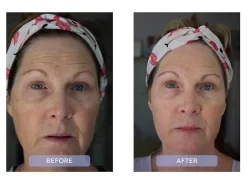 Dr. Zenovia Skincare Peptide + Ceramide Repairing Moisturizer -Classic Skin Care Product Store qwy0uawj 202203151410109728