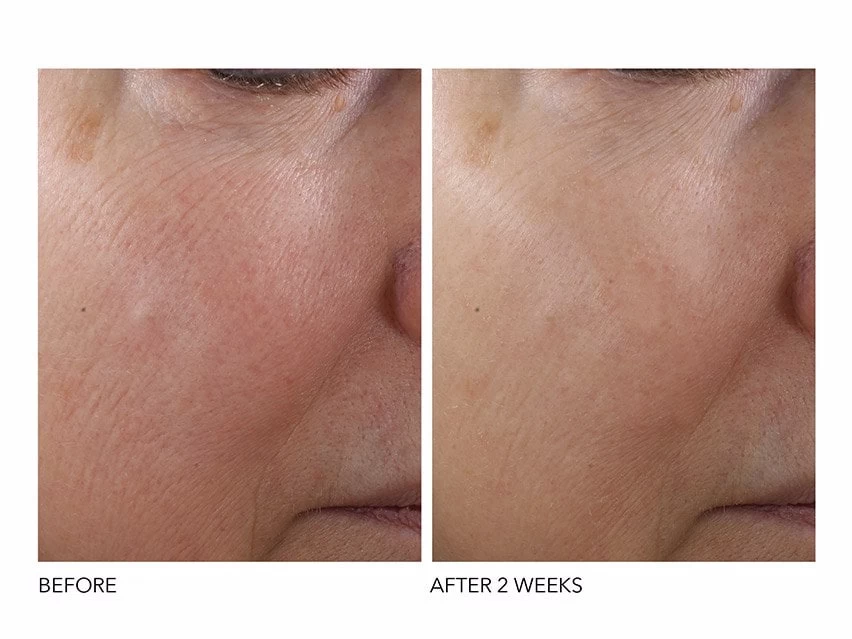 Dr. Dennis Gross Skincare Advanced Retinol + Ferulic Texture Renewal Serum 2 Dr. Dennis Gross Skincare Advanced Retinol + Ferulic Texture Renewal Serum - Image 2