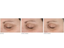 MEG 21 Bright & Firm Eye Treatment -Classic Skin Care Product Store rqa2k0cx 201612272125180726