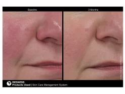 Jan Marini RosaLieve Redness Reducing Complex -Classic Skin Care Product Store rrct4vvx 201803121530147703