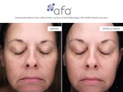 Afa Restorative Gel Plus -Classic Skin Care Product Store sfwuqdxb 202107131936230174