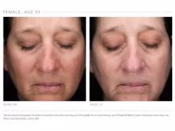 Emepelle Serum -Classic Skin Care Product Store sg0ltu4p 202102161750368300