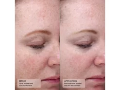 Sentè Bio Complete Serum -Classic Skin Care Product Store sl1c44hb 202305041836098576