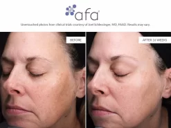 Afa Restorative Gel Plus -Classic Skin Care Product Store tjqmyv5k 202107131938059584