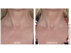 DefenAge 6-Week Perfection Neck Cream -Classic Skin Care Product Store txctkhk2 202011052250125520