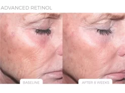 LovelySkin LUXE Advanced Retinol Serum -Classic Skin Care Product Store ua0khf1v 202111302024103305