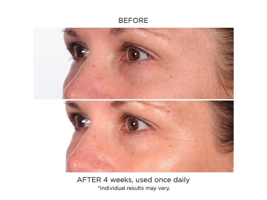 NassifMD® Daily Revitalizing Serum 3 NassifMD® Daily Revitalizing Serum - Image 3