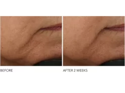 Dr. Dennis Gross Skincare Advanced Retinol + Ferulic Intense Wrinkle Cream -Classic Skin Care Product Store uz2ixngh 202112311952249681