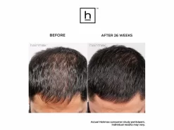 HairMax LaserBand 41 ComfortFlex Hair Growth Device -Classic Skin Care Product Store vapgk5iw 202211091914008625