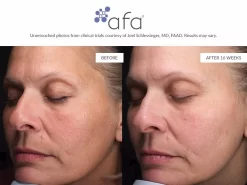 Afa Restorative Gel Plus -Classic Skin Care Product Store vbzebp0n 202107131914099162