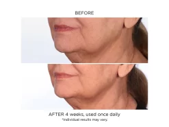 NassifMD® Daily Revitalizing Serum 9 NassifMD® Daily Revitalizing Serum -Classic Skin Care Product Store vlgef4l2 202009221846086994