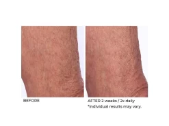 NassifMD® Crepe Inhibitor Triple Action Body Butter -Classic Skin Care Product Store weldbg5s 202009221703373178