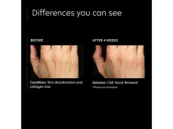 PCA SKIN C&E Hand Renewal -Classic Skin Care Product Store wwpa02vl 202205262011029430