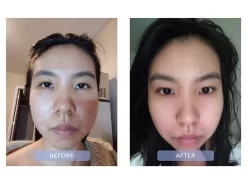 Dr. Zenovia Skincare Aloe Vera Blemish Soothing Moisturizer -Classic Skin Care Product Store xnscllf1 202203142028206746