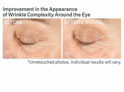 StriVectin Advanced Retinol Multi-Correct Eye Cream 11 StriVectin Advanced Retinol Multi-Correct Eye Cream -Classic Skin Care Product Store y3ryn22q 202210261739040387