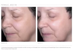 Emepelle Serum -Classic Skin Care Product Store yfjzsnop 202102161752522068