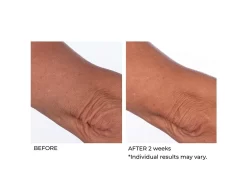 NassifMD® Crepe Inhibitor Triple Action Body Butter -Classic Skin Care Product Store yp3dhf0t 202009221702583429