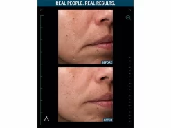 Allies Of Skin Multi Peptides & GF Advanced Lifting Serum 19 Allies Of Skin Multi Peptides & GF Advanced Lifting Serum -Classic Skin Care Product Store yr1rtxmq 202306271836070053