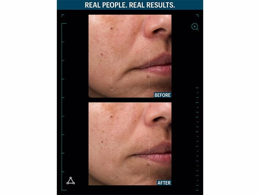 Allies Of Skin Multi Peptides & GF Advanced Lifting Serum 6 Allies Of Skin Multi Peptides & GF Advanced Lifting Serum - Image 6