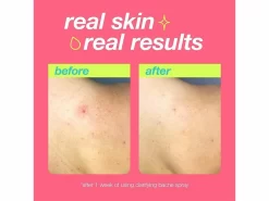 Dermalogica Clear Start Clarifying Bacne Spray -Classic Skin Care Product Store yry223aa 202306121410164345