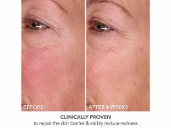 Dr. Dennis Gross Skincare DermInfusions Fill + Repair Serum -Classic Skin Care Product Store ywnprcfp 202303231527217708