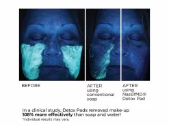 NassifMD® Complexion Perfecting Detoxification Pads -Classic Skin Care Product Store za1nqhks 202009221648295430