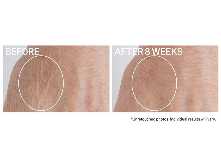 Strivectin Crepe Control Brightening And Firming Hand Cream - Limited Edition 3 Strivectin Crepe Control Brightening And Firming Hand Cream - Limited Edition - Image 3