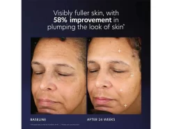 PCA SKIN Pro-Max Age Renewal Advanced Serum -Classic Skin Care Product Store zlm0rnox 202305231702212560